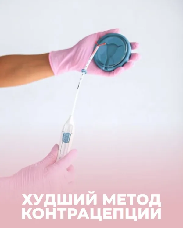 Худший метод контрацепции по мнению репродуктолога --- внутриматочная спираль